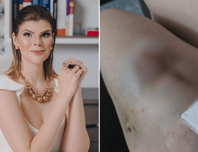 Médica do Paraná se torna ré por dar falsos diagnósticos de câncer de pele e recomendar cirurgias desnecessárias